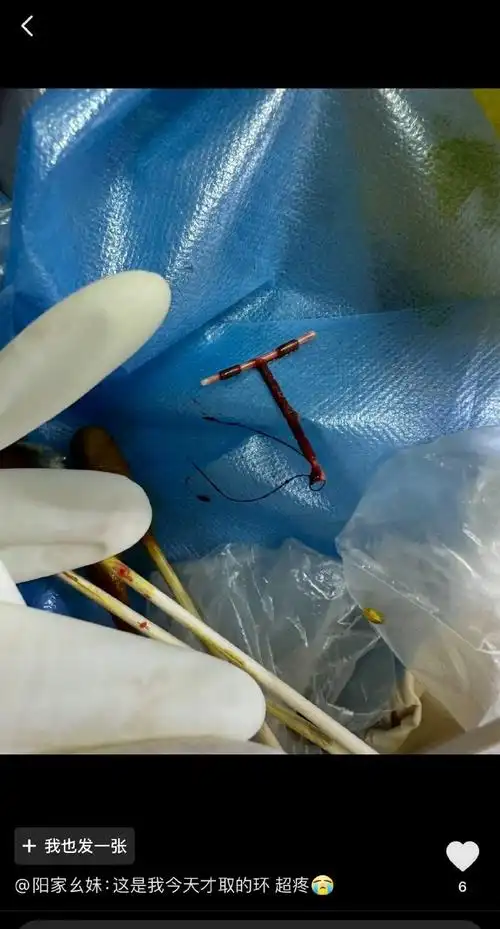 带妈妈去取环##妇产科迎来关停潮