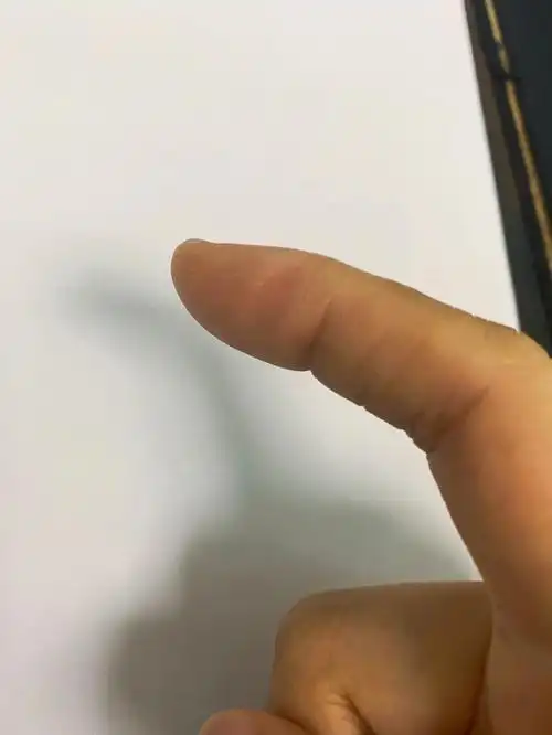 二十天产生了范性形变