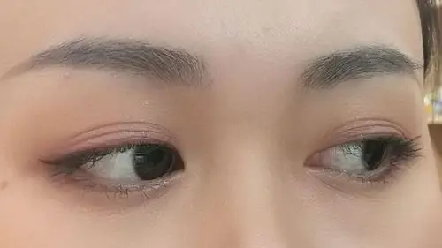 拥有三眼皮是一种什么感受?