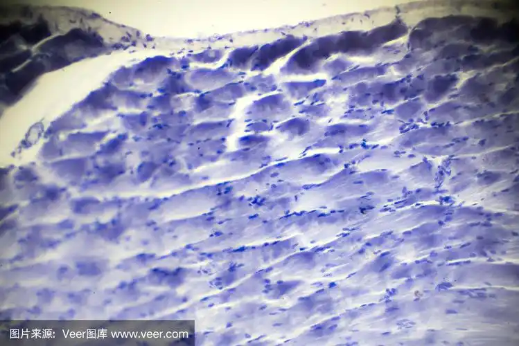 显微镜下骨骼肌纵切面