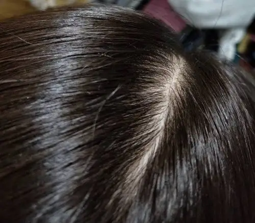 这样的发量正常吗?如图本人女,头发天生细软,请问这样的发量正常吗?