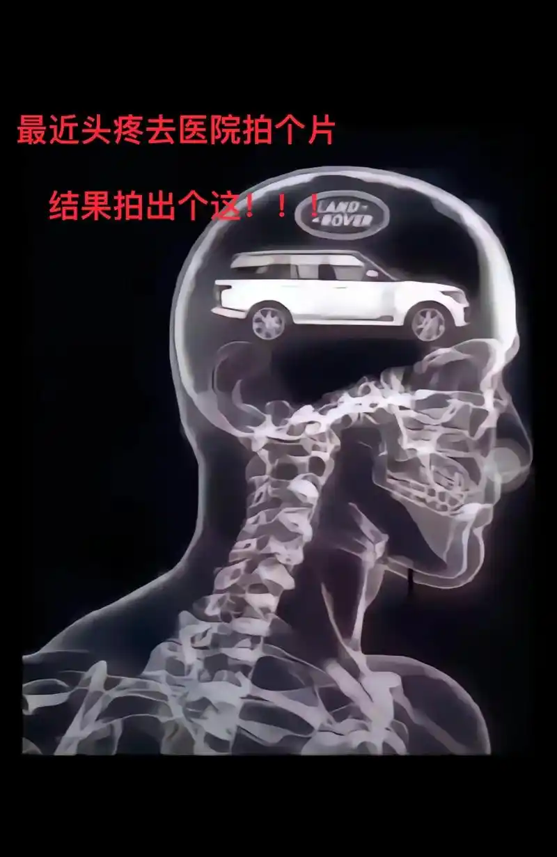 好头疼01.最近头疼去医院拍个片  结果你看脑袋里都是啥#一 - 抖音