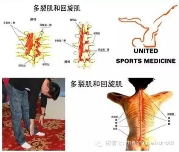 肌肉解剖多裂肌回旋肌与腰突