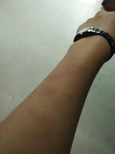 这手痒痒的.不知怎么了.