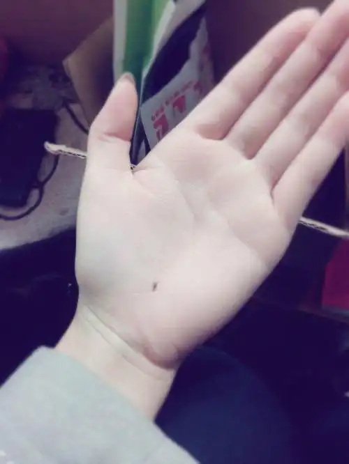 掌心有痣是什么体验