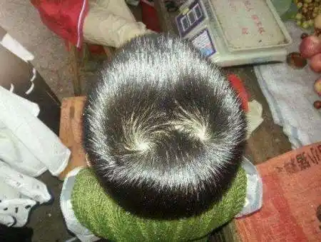 想留头发理发师告诉顺着头发旋方向留,今天我就仔细看了一下方向,一看