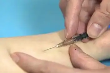 ppd试验多长时间看结果_百度视频搜索