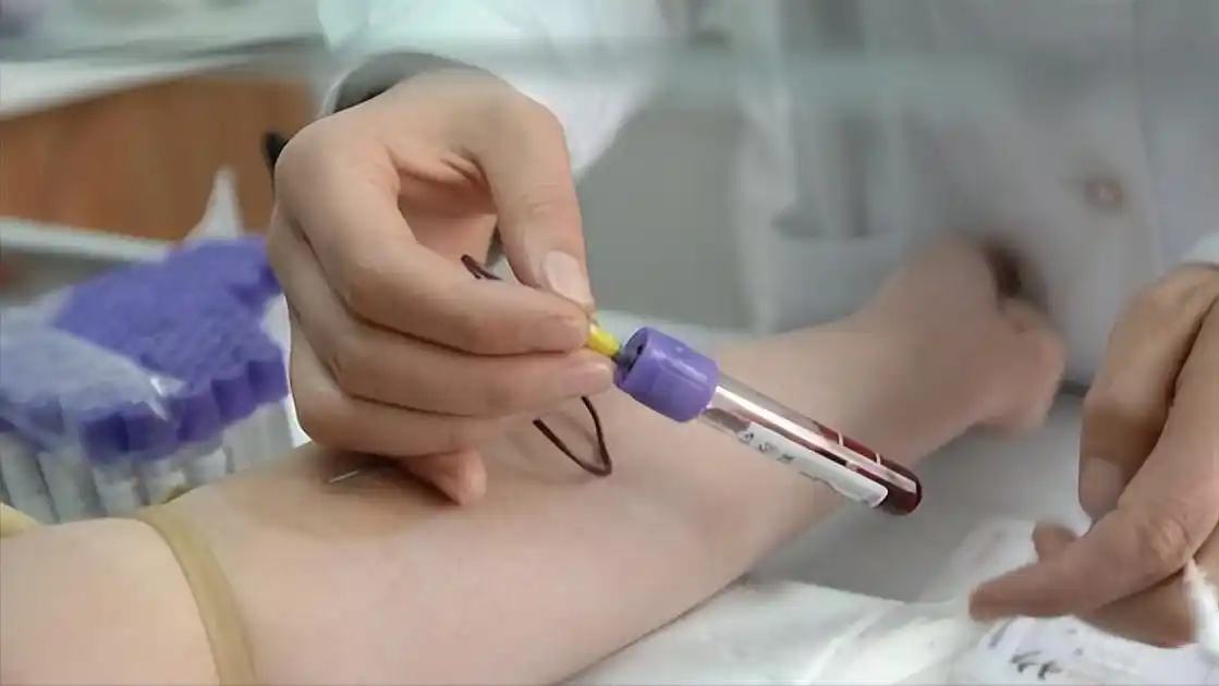 化验血多少钱一次(抽血能检查出什么病) - 价格百科