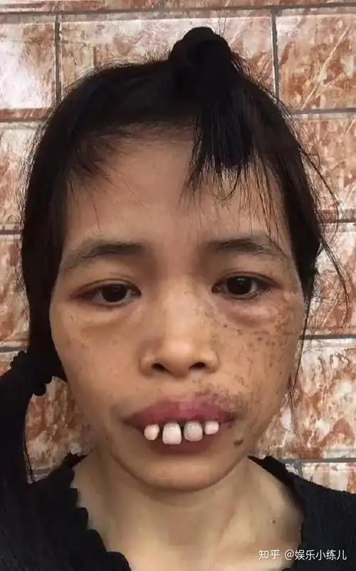广东女子因长相奇特成大网红一口龅牙无处安放网友抢着要娶她