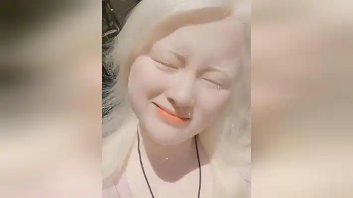 白化病女生晒出阳光下的自拍,天使般的面容让人沦陷