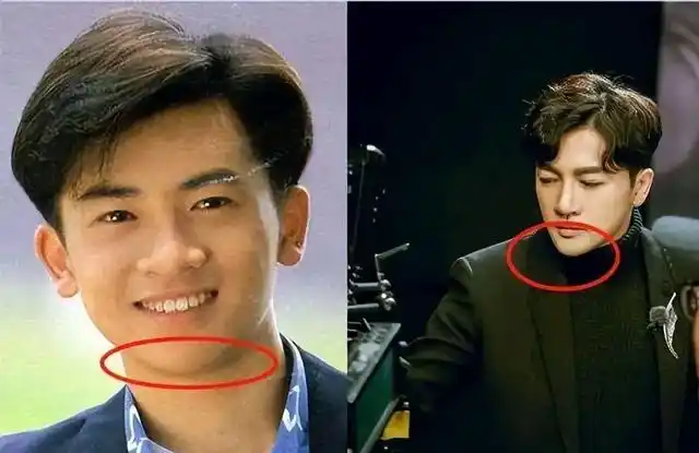 男明星动脸现状:陈浩民变成"马里奥",吴刚苹果肌笑起来很僵硬