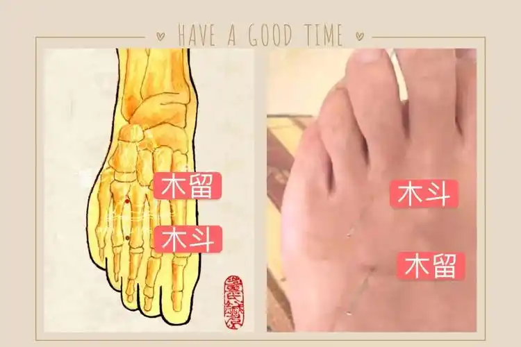 【针灸】董氏针灸中风偏瘫处方