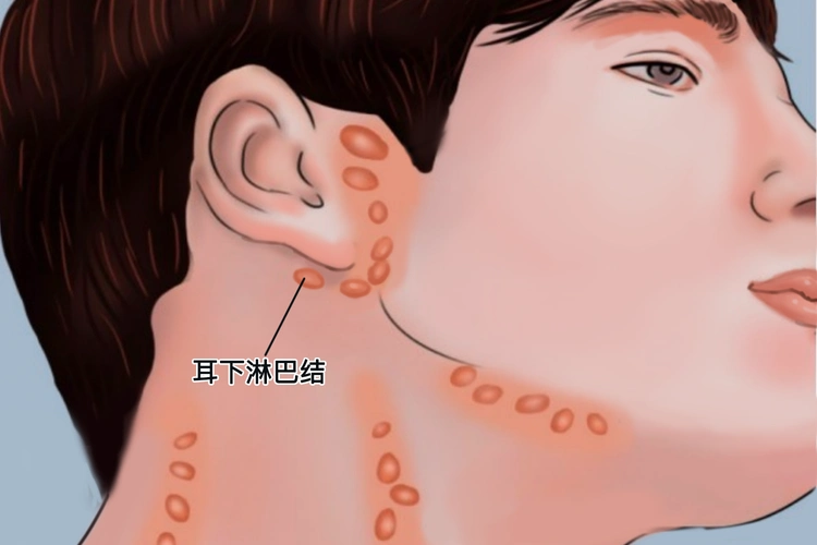耳垂下的淋巴结位置图_有来医生