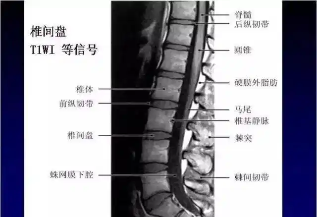 10分钟自学腰椎阅读核磁共振片