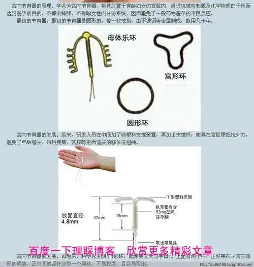 避孕环图(女性上环图解)_值得一看_老猫资源网-老猫娱乐网,专注收集