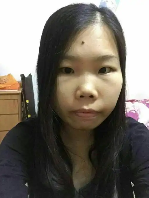 姐姐重度地中海贫血,需骨髓移植手术,希望大家救救她!