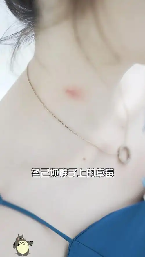 你觉得冬己脖子上的草莓是谁的杰作