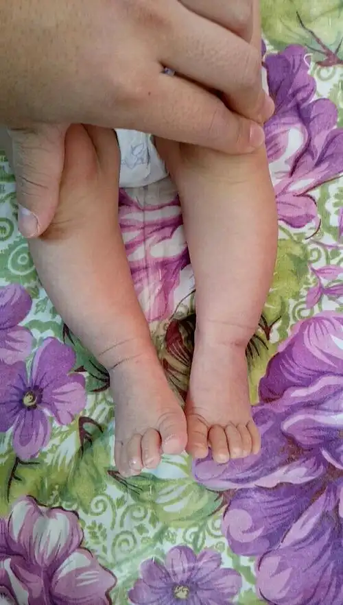 各位宝妈过来帮忙看看,我家宝贝的腿正常吗