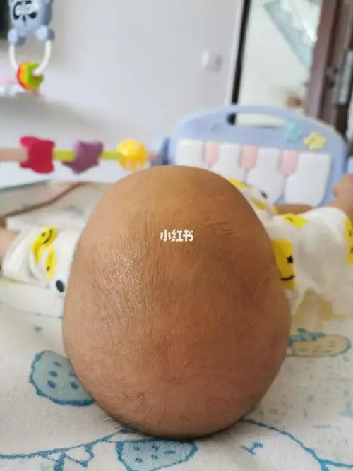 宝宝这个头型是不是算尖头啊