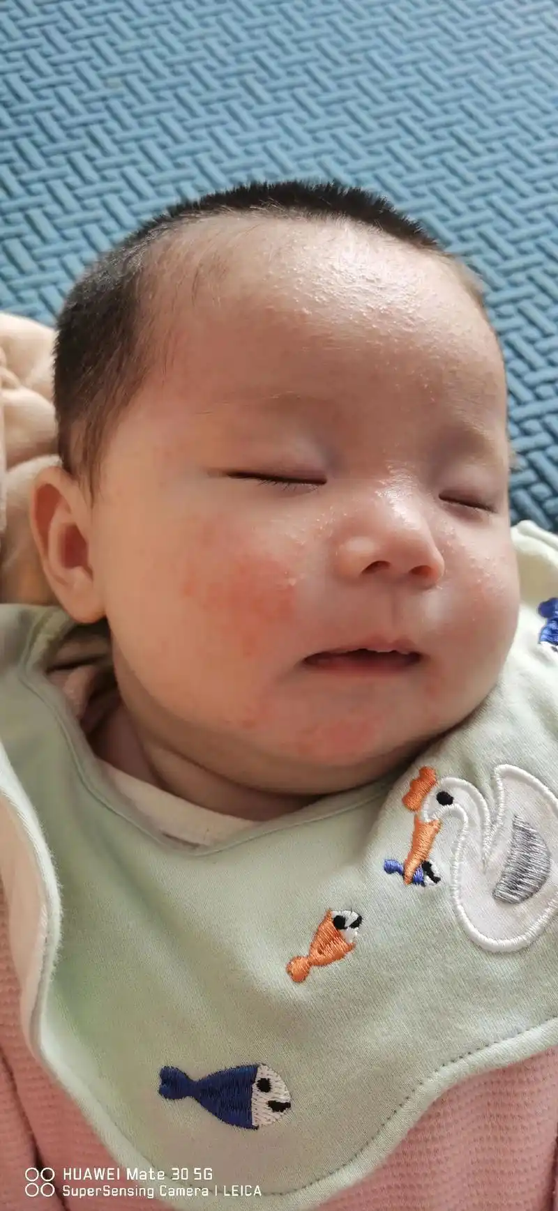 leica2个月了结果长了一脸的湿疹有没有什么好的办法oohuaweimate305g