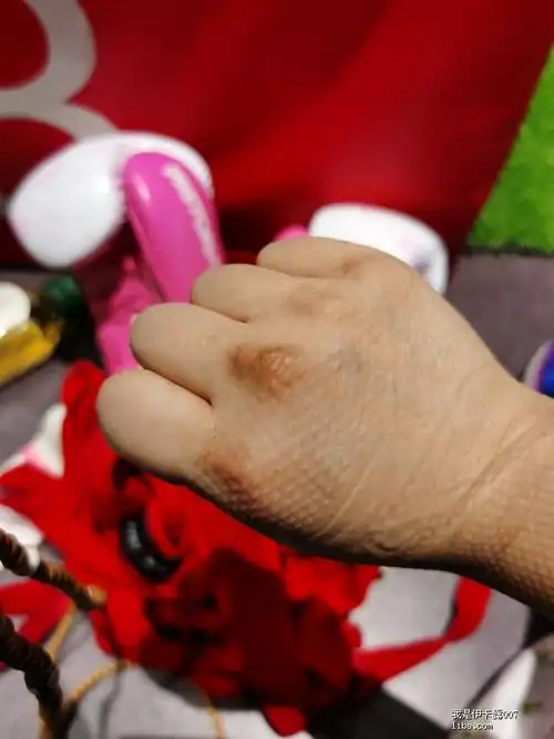 我现在这个手戴戒指难看死了