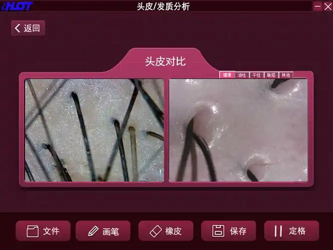 健康头皮与健康头皮对比 中文简体