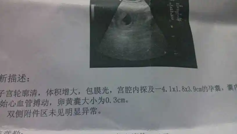 38天孕囊是0.9*0.7*0.5 50多天孕囊是4.1*1.8*3.