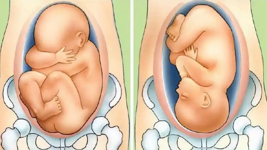 不知道你说的是医学里的还是经济上的 胎位roa,表示胎儿是枕右前位,是