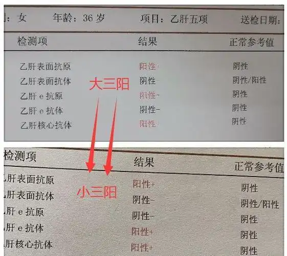 血症|大三阳|小三阳|抗病毒_网易订阅