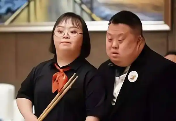 这种病症也被称为21三体综合征,在很多国家也被称为"国际面孔",因为