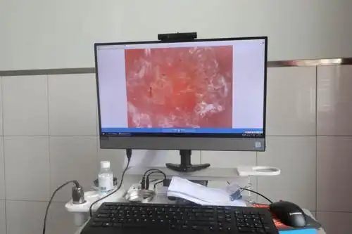 平庄矿区总医院设备简介:皮肤镜