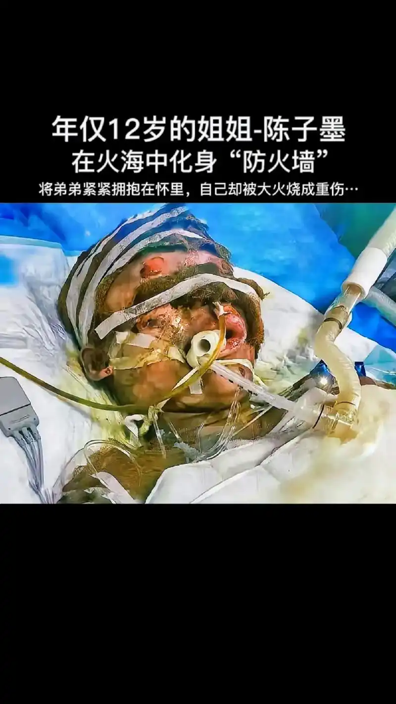 深夜家里突发大97,眼看大火就要将弟弟吞没,子墨边喊爸爸边将 - 抖