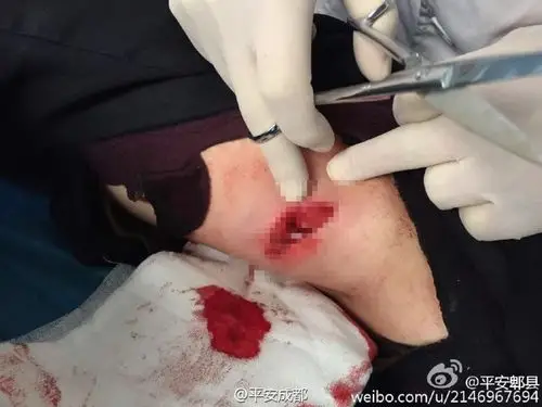 开枪的年轻民警担心流弹伤到群众,一犹豫,大腿被