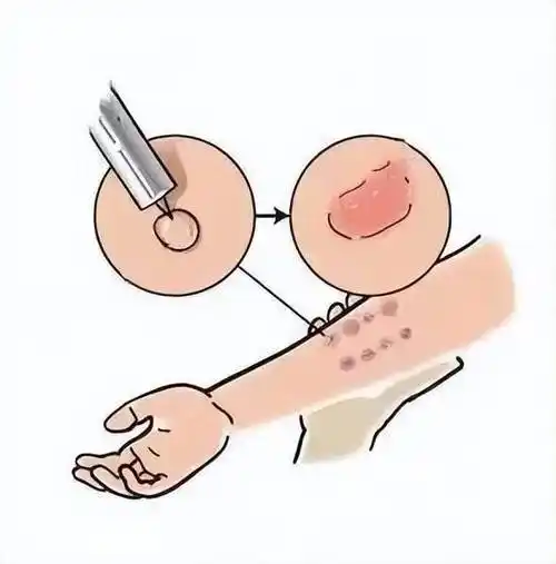 家长们请查收这份学生ppd筛查服务攻略