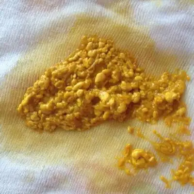 一个多月的宝宝,便便一直是这种样子的,正常嘛?