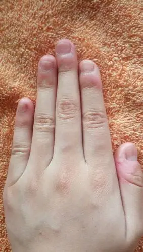 怎样让指甲不上翘,然后红的肉比较多,而