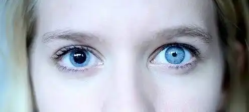 瞳孔收缩/放大的效果对比图