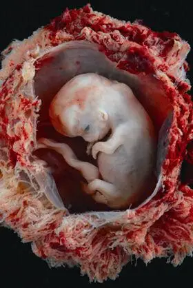 图2-15周胚胎 图片来源@社团的微博