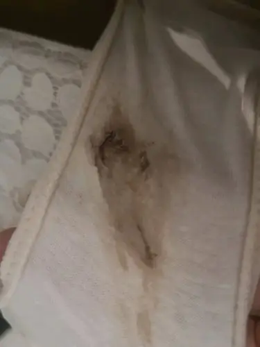 排卵同房两三天后有少量褐色分泌物