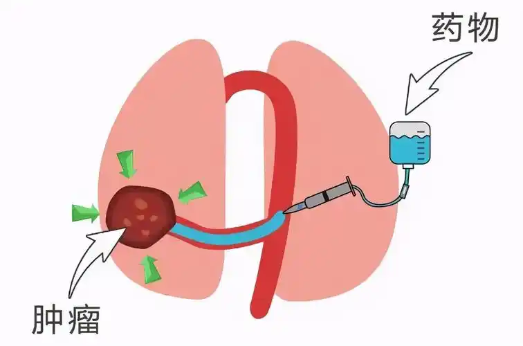 精准介入医路有我一起揭开介入科神秘面纱