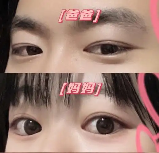 接好宝宝双眼皮来咯