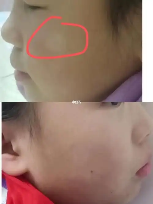 这个白斑原来不是肚子有虫了