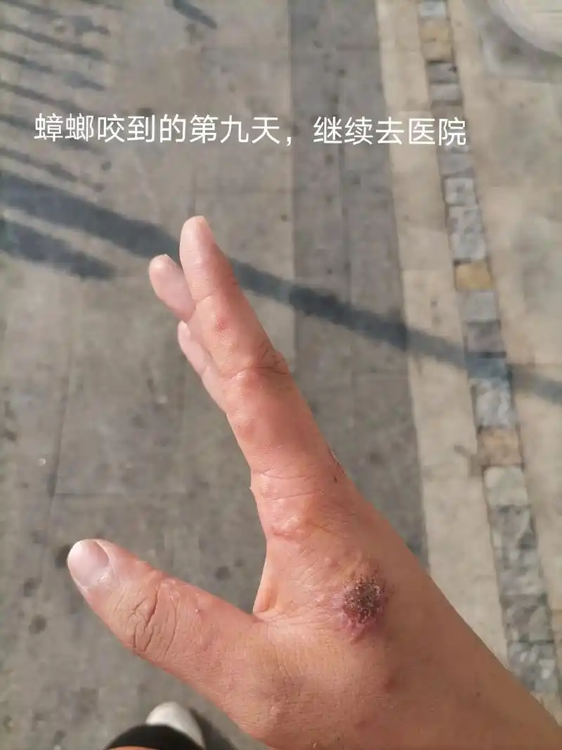 蟑螂 #无助感 #痛苦面具 😭😭😭😭😭😭😭� - 抖音