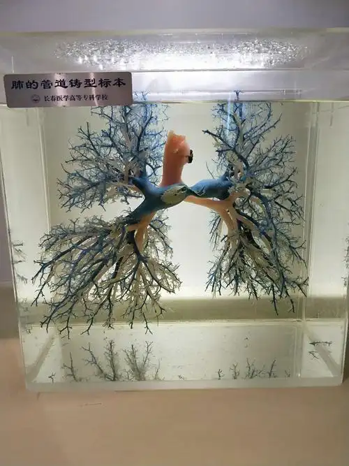 肺的管道标本