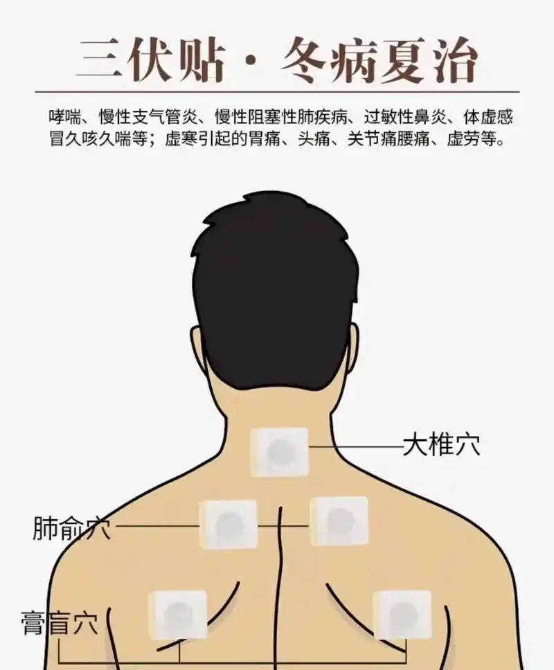 家人们三伏贴的穴位图建议收藏,祝大家吉祥安康,@#老祖宗传下 - 抖音