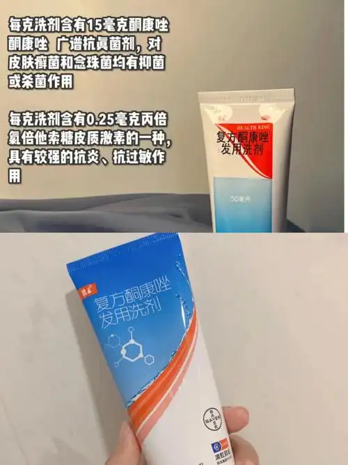 关于脂溢性皮炎头皮螨虫头皮痒的那些事