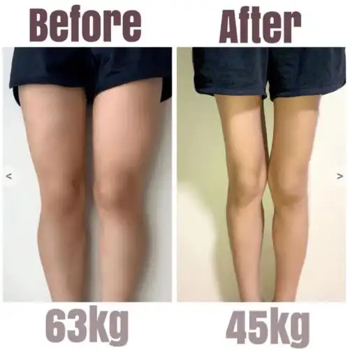 part 7- 大腿&小腿小胖手变纤纤玉指,戴的戒指也从原来的12号减小到9