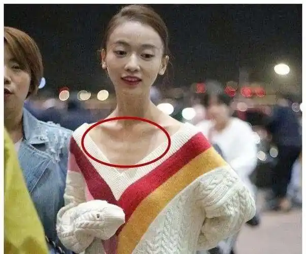 实在是太瘦了baby现身瘦到皮包骨头肋骨外翻不到九十斤惹人心疼