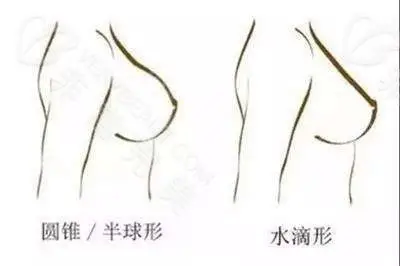 假体隆胸圆形好看还是水滴形好看假体隆胸效果图展示