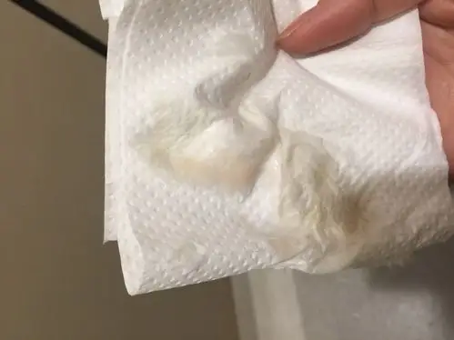 1对1!怀孕了还会有白带吗"高端助孕"-第1张图片-金凯博客